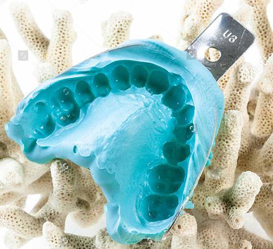 Dental alginate impression materials