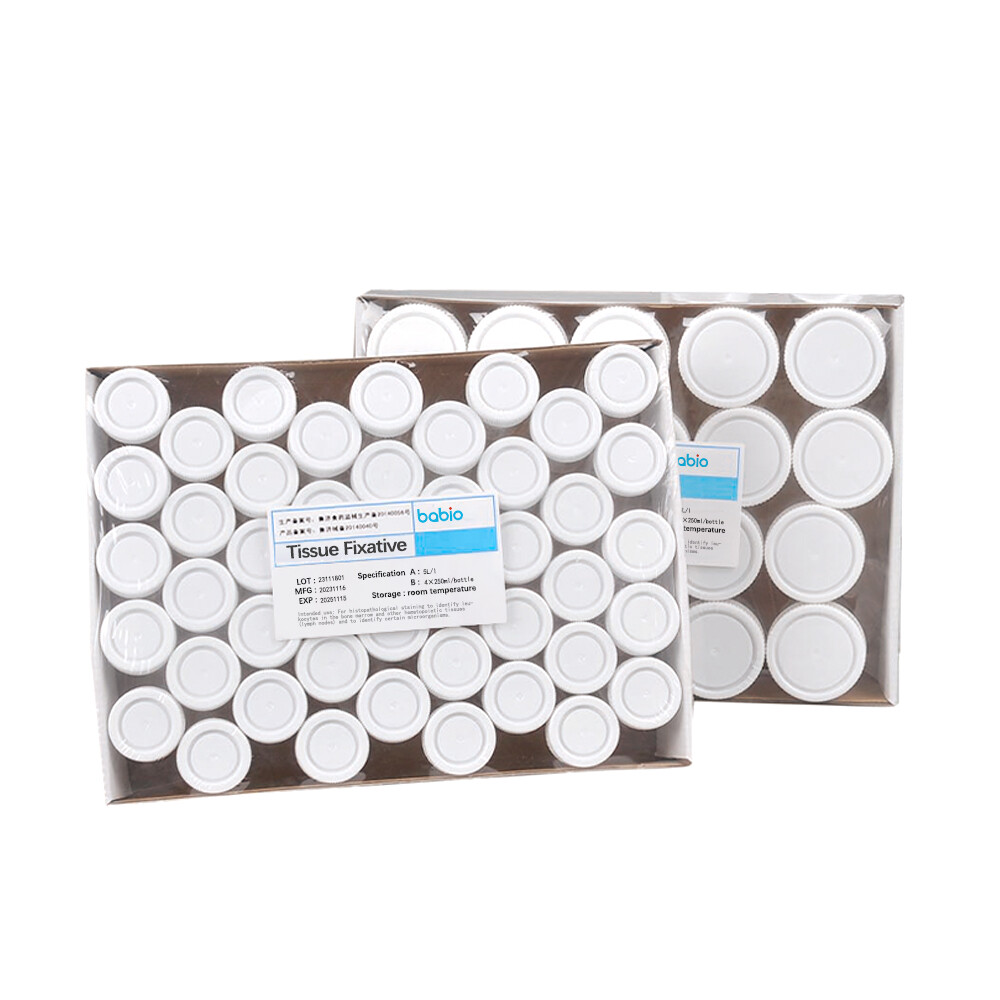 Professional Tissue Fixative for Fresh Tissue Samples - 10% & 13% ...