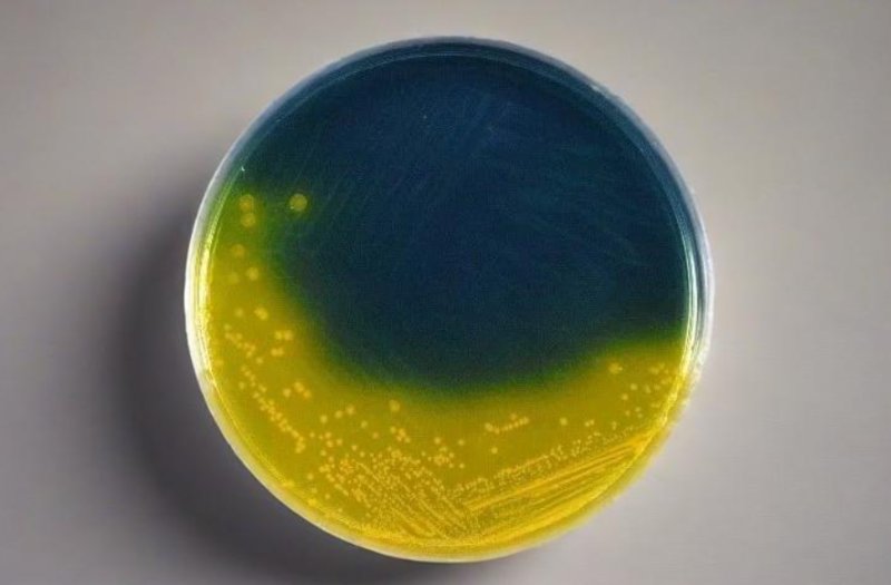 Ensuring Food Safety: Babio’s Salmonella Shigella Agar (SS) Supports Global Pathogen Detection Standards