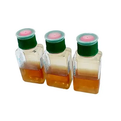 Babio Launches Advanced Blood Culture Bottle for Accurate Pathogen Detection