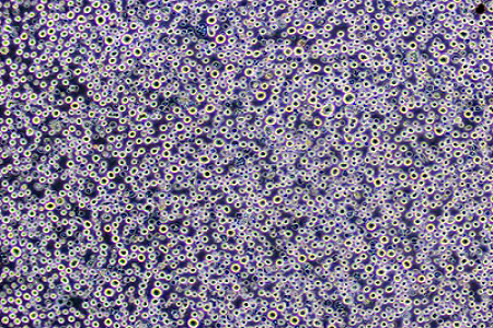 BABIO élargit ses solutions de transport d’échantillons pour les laboratoires de microbiologie