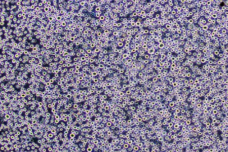 BABIO amplía las soluciones de transporte de muestras para laboratorios de microbiología