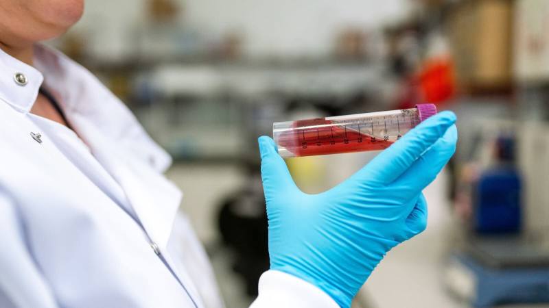 Cary Blair Transport Media: An Essential Tool in Microbiology