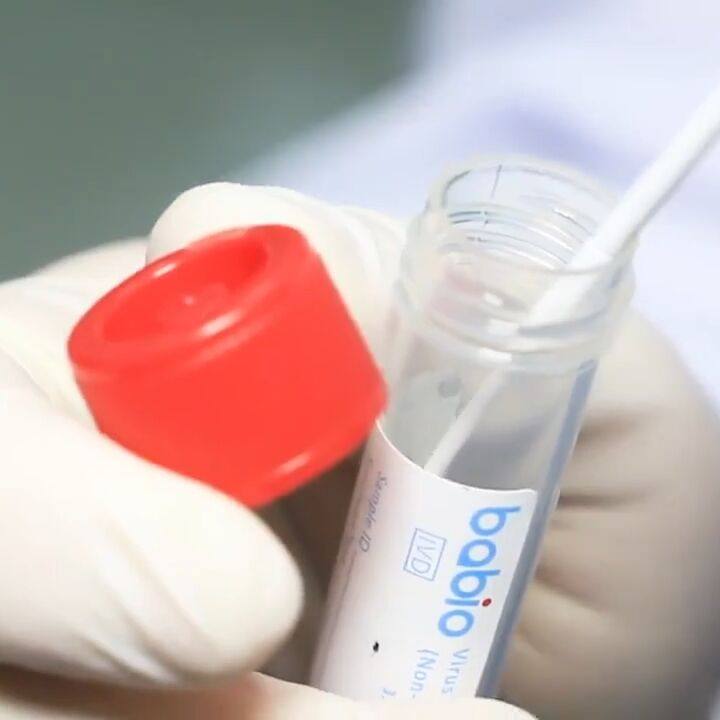 BABIO Phosphate Buffered Saline (PBS): Ready-to-Use Solution for Specimen Handling