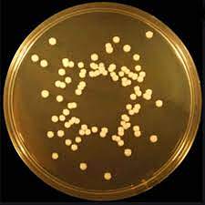 La gélose Sabouraud Dextrose révolutionnaire : Un changement de donne dans la culture des champignons