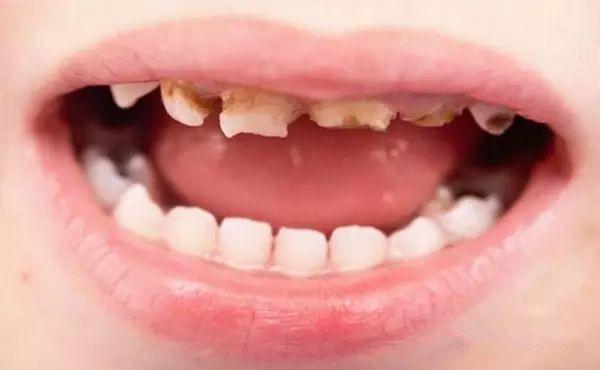 Faire progresser la détection des caries : Solutions innovantes de Baibo