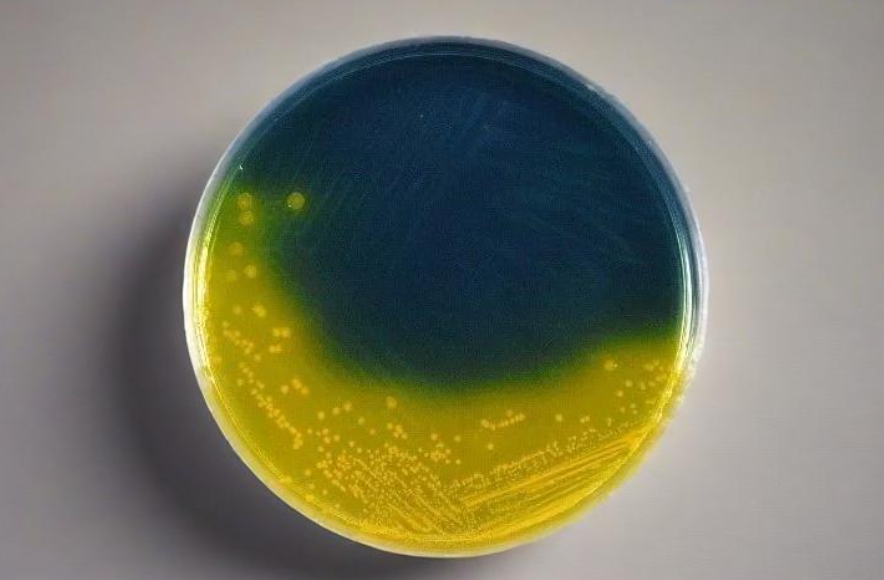 Ensuring Food Safety: Babio’s Salmonella Shigella Agar (SS) Supports Global Pathogen Detection Standards