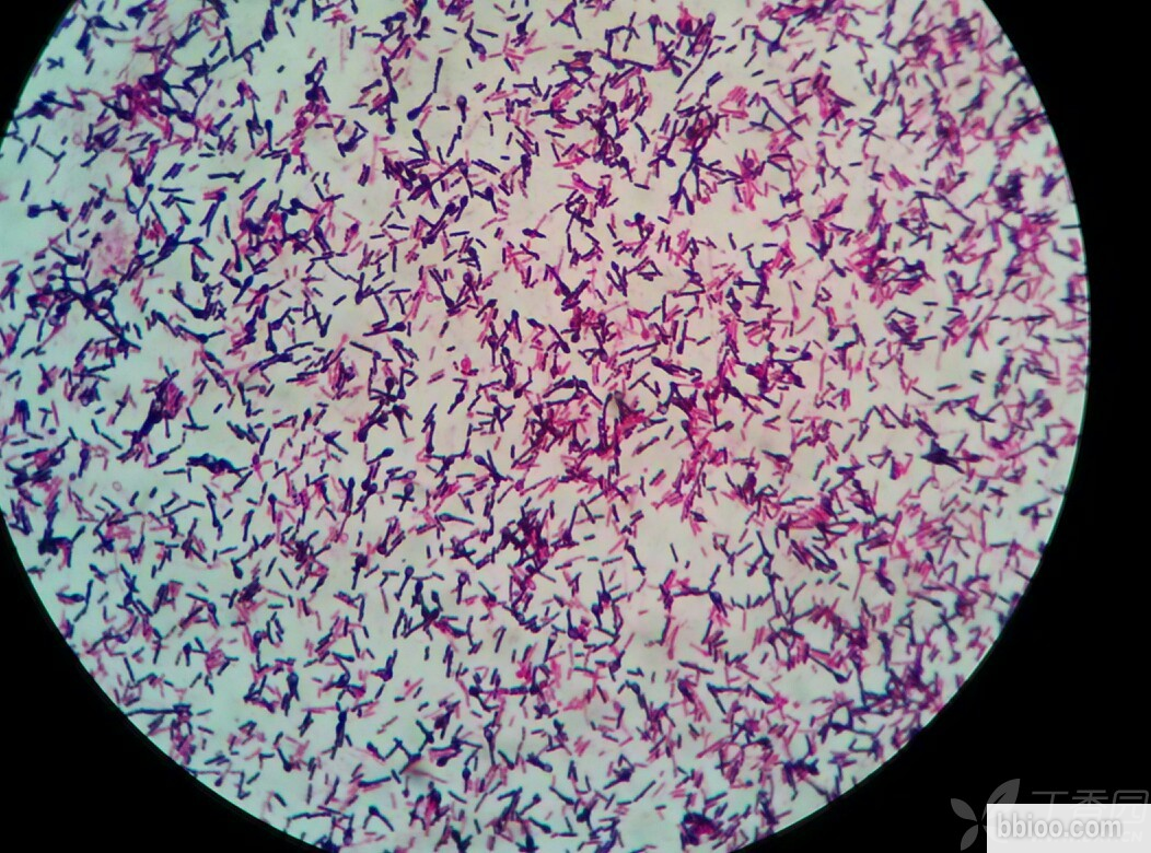 Kit de coloration de Gram par BABIO : Solution de confiance pour une identification bactérienne précise