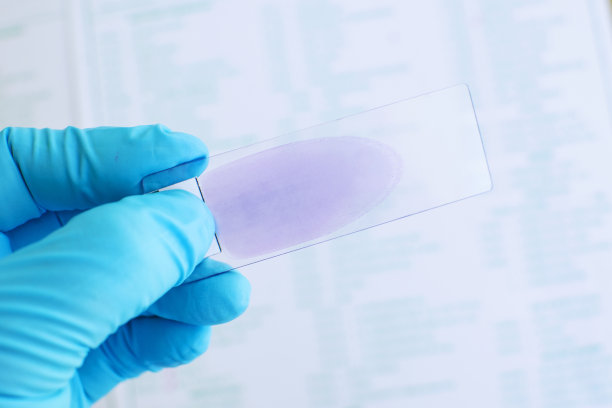 Revolucionando la detección de la malaria: El kit combinado de antígenos P.f/P.v del paludismo de Baibo