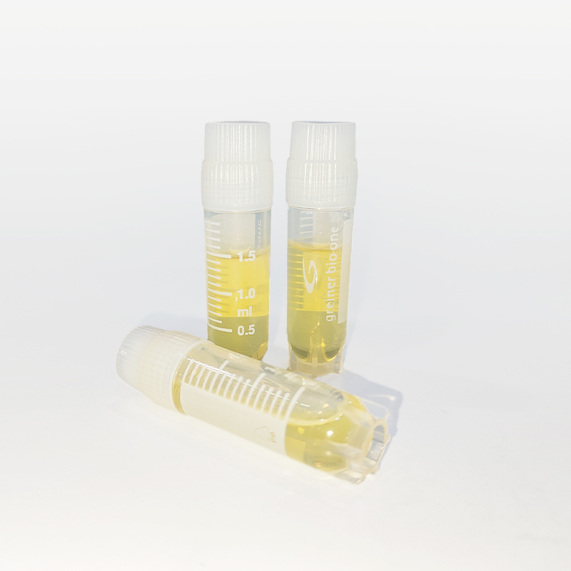 STGG Medio de transporte