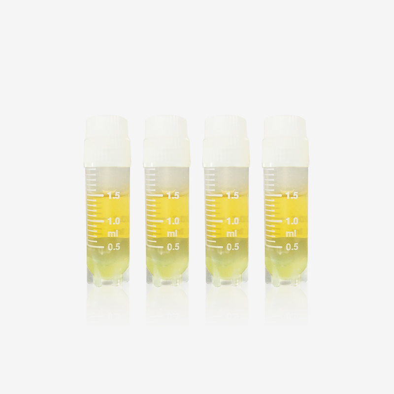 STGG Medio de transporte