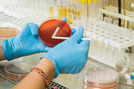 BABIO lanza el medio de agar R2A de alto rendimiento para el monitoreo ambiental global