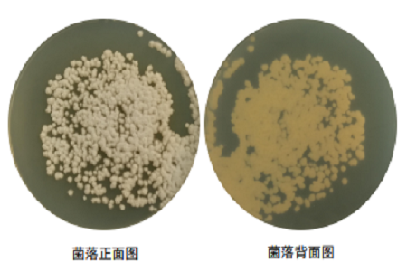 BABIO mejora la microbiología global con el medio Agar Dextrosa de Papa
