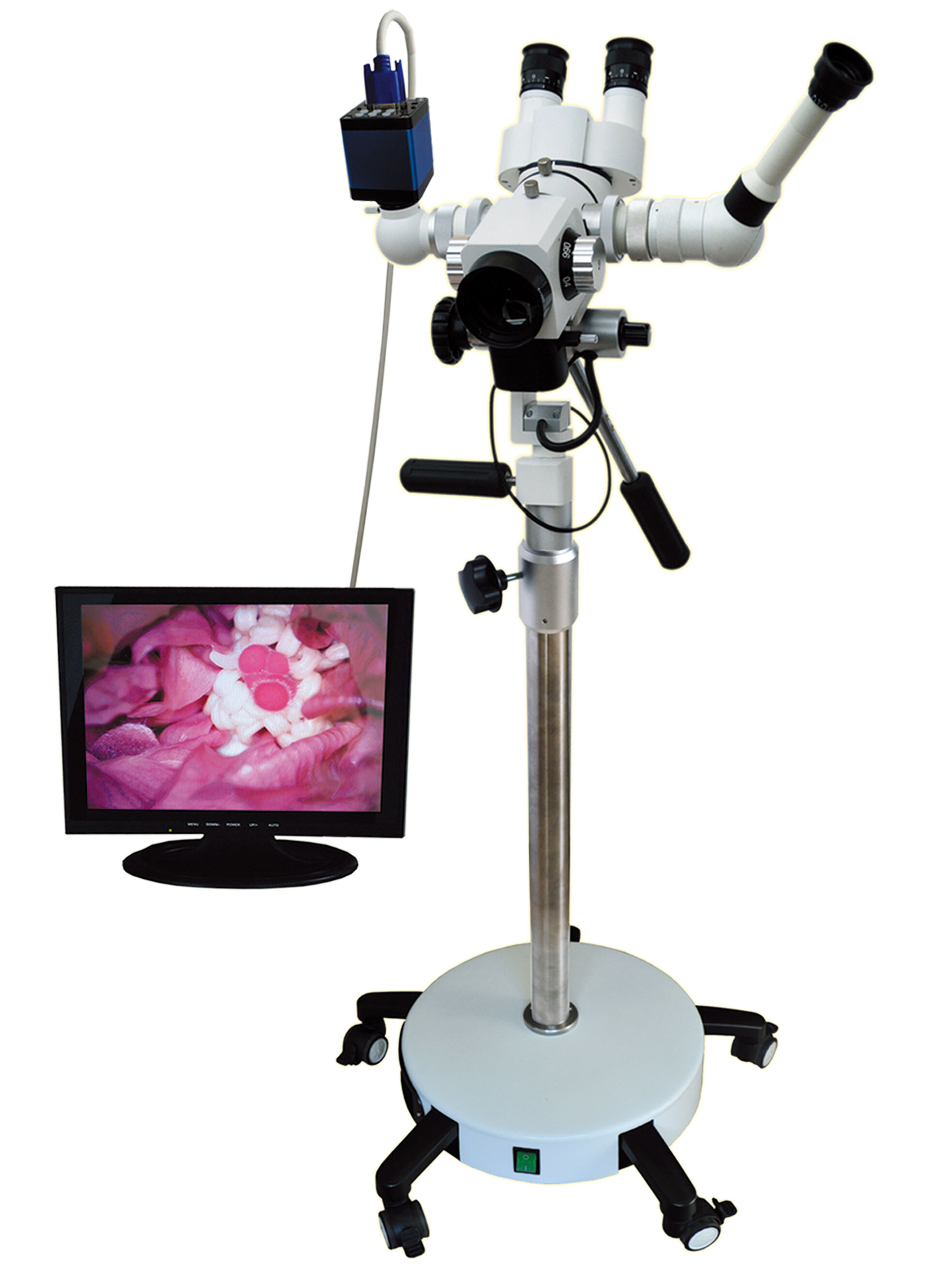 Digital Optical Colposcope 