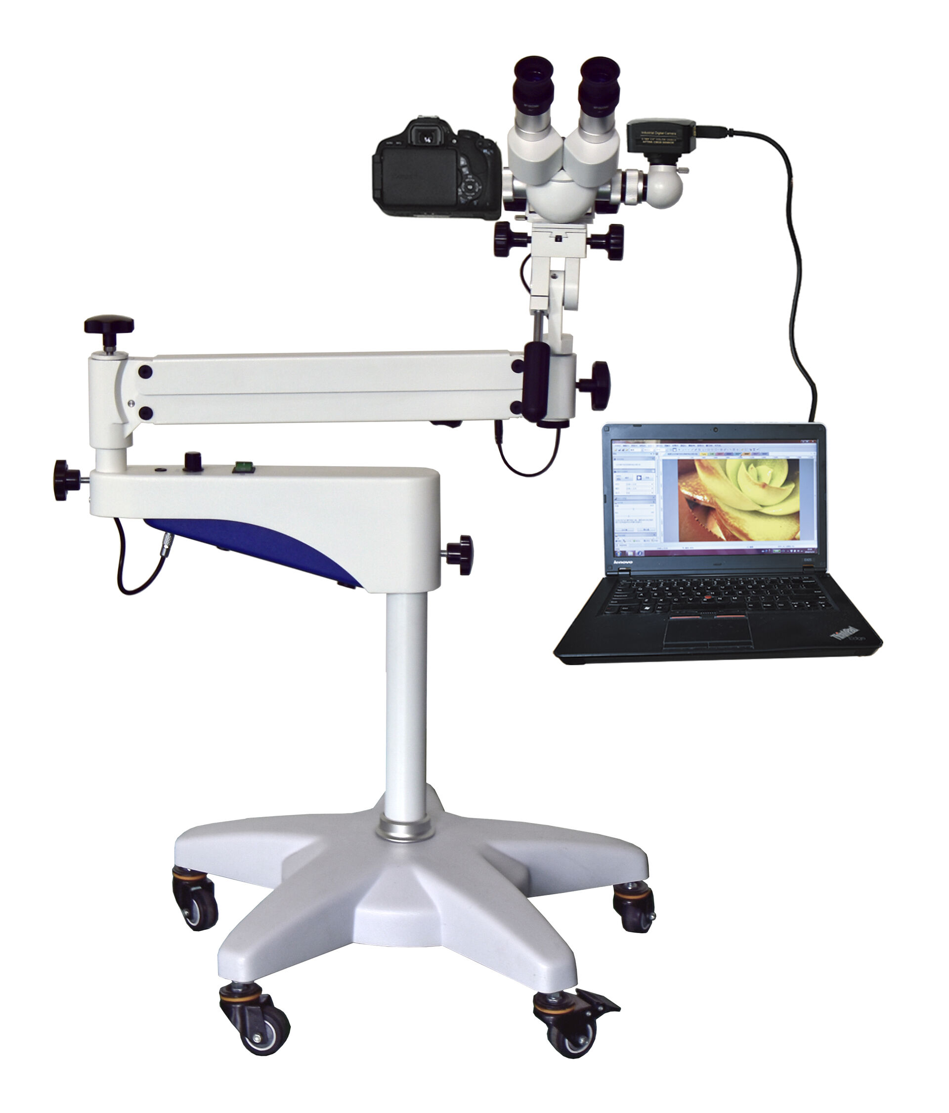 Digital Optical Colposcope (Zoom Magnification ）