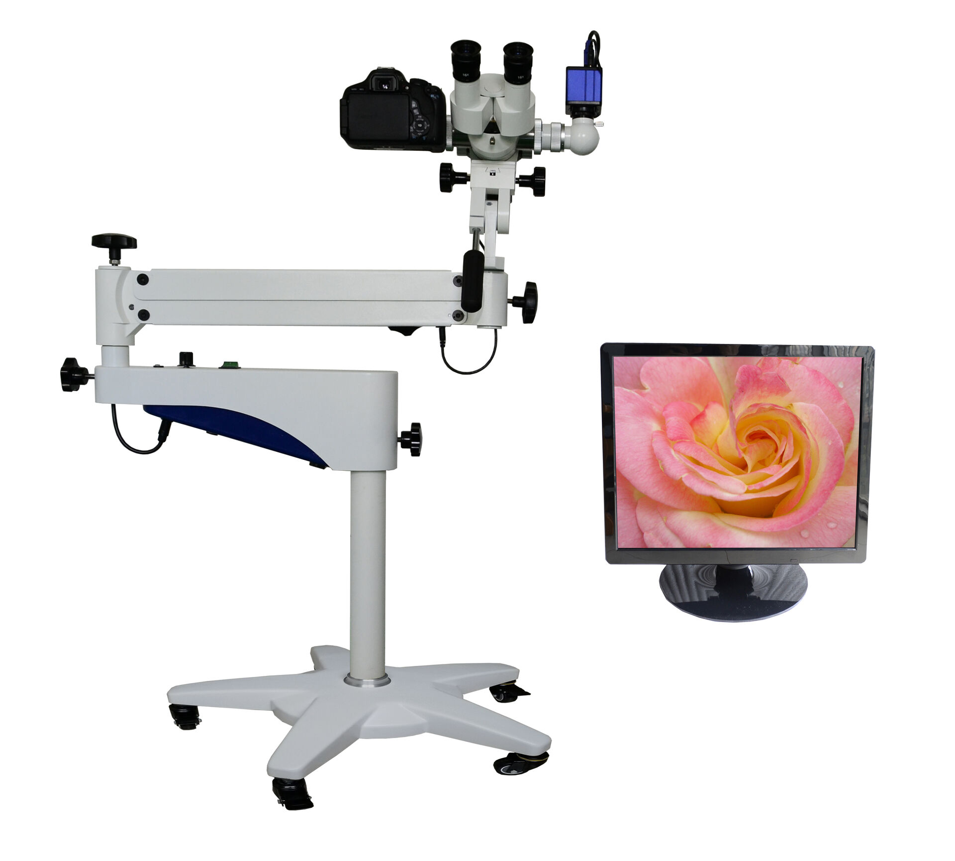 Digital Optical Colposcope (Zoom Magnification ）