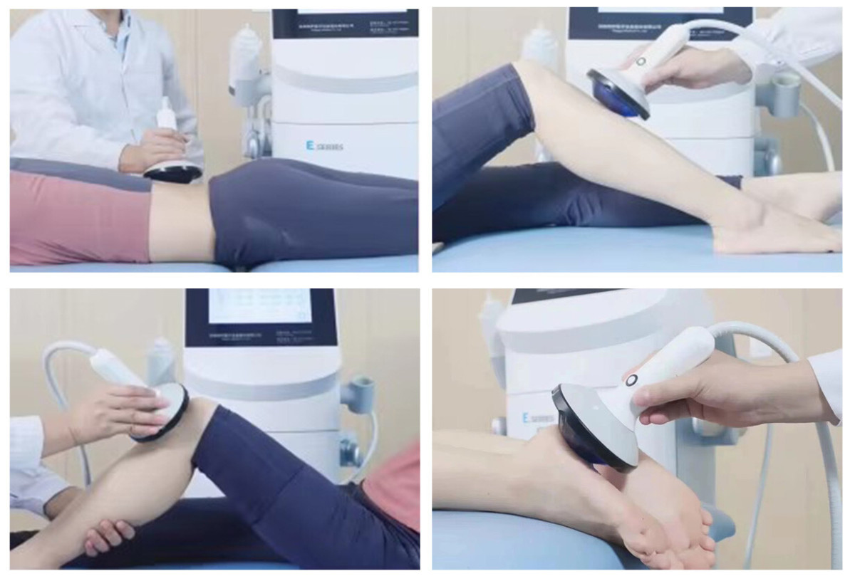 未标题-2.jpg Piezoelectric Shock Wave Therapy Device
