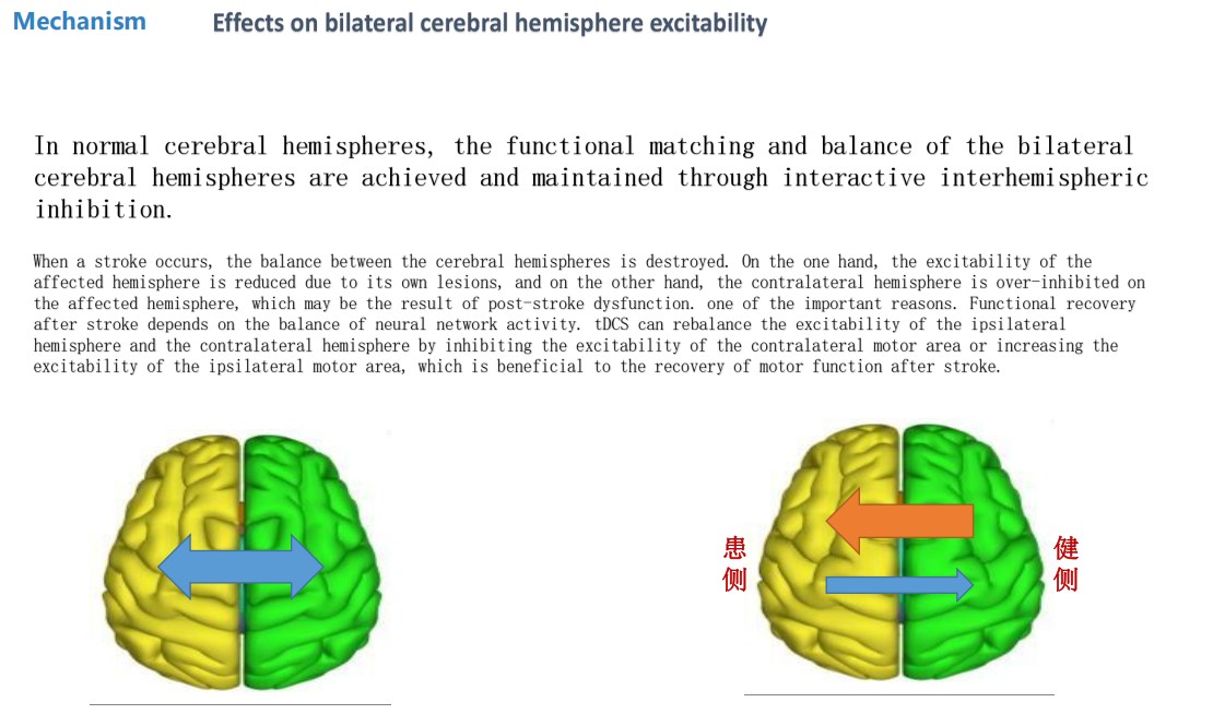 072c7c24c45bafb399307802426f64a.png TDCS Transcranial Electrical Stimulator