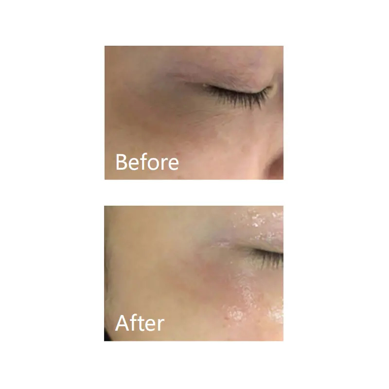 Мезо Осветление