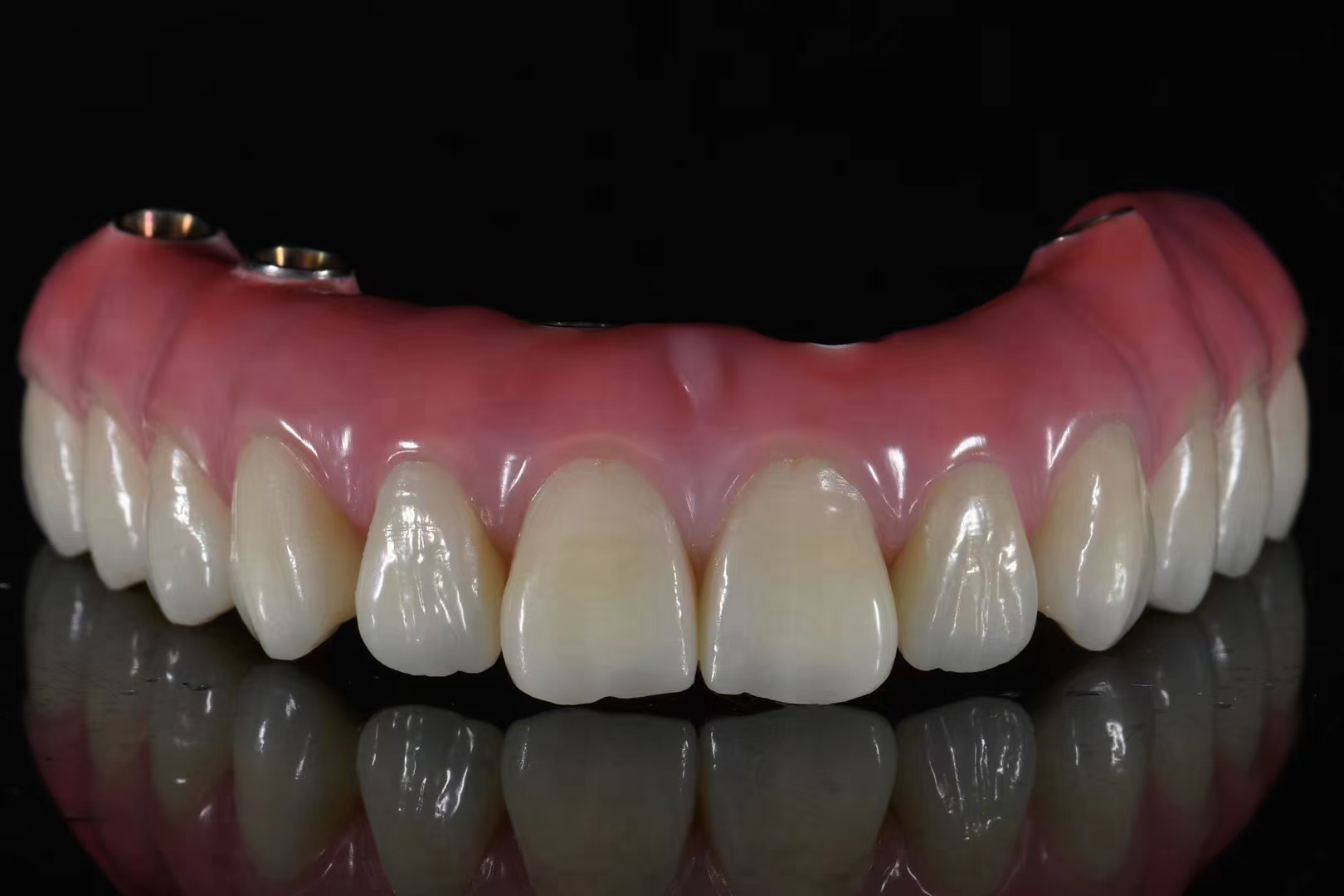 Dental Implants