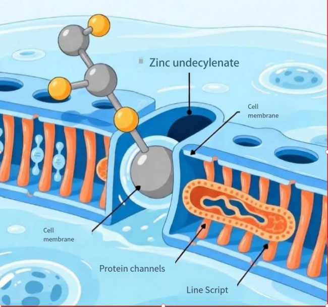 Zinc undecylenate: The 