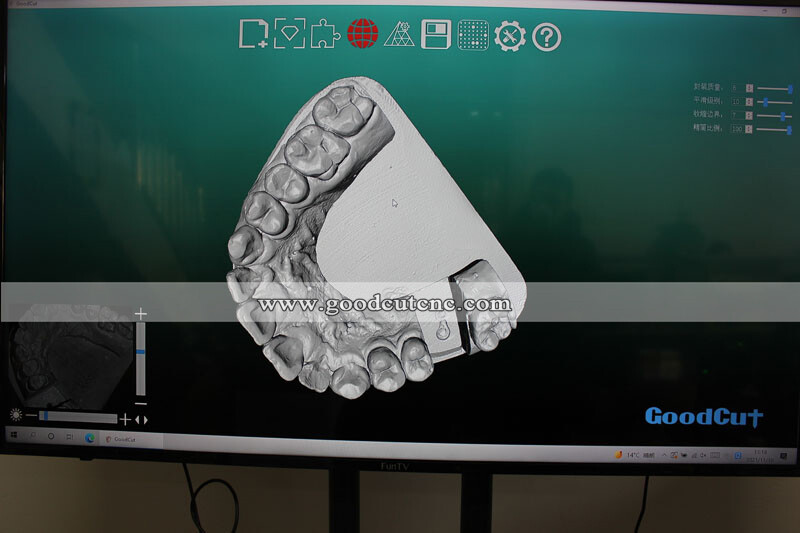 3D Dental Scanner-2.jpg
