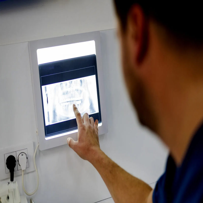  Instrumentos y equipos industriales Tapa de cristal