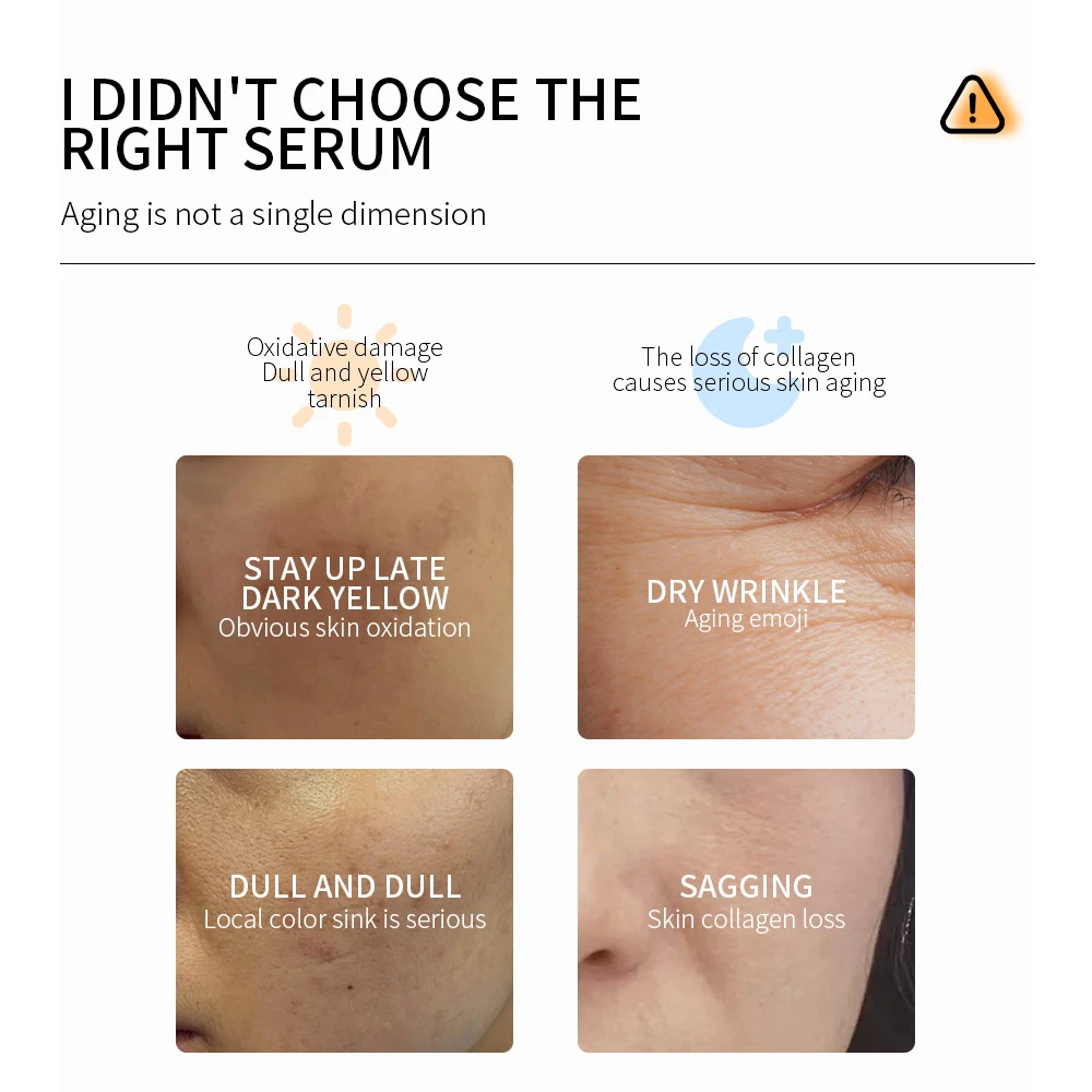 VC Essence