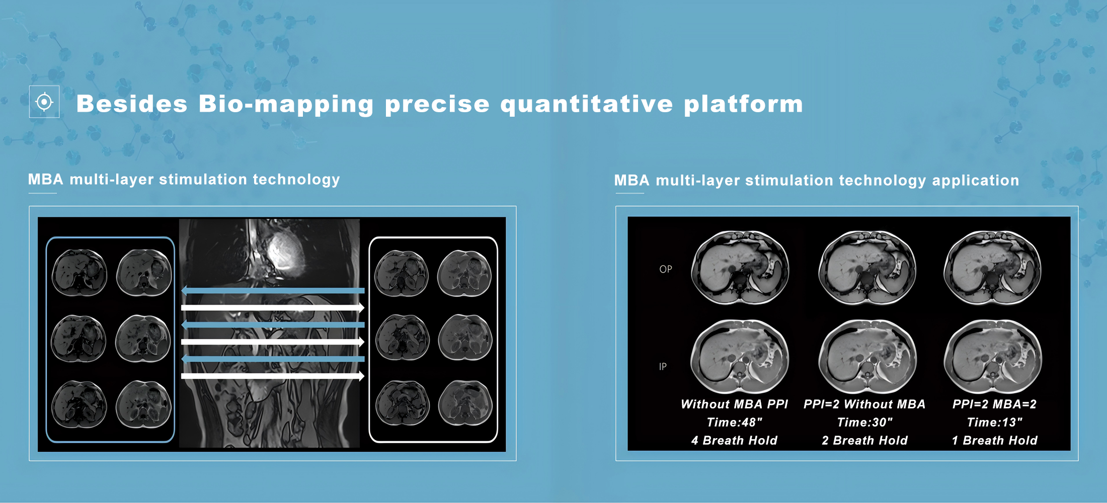 MRI medical features 5