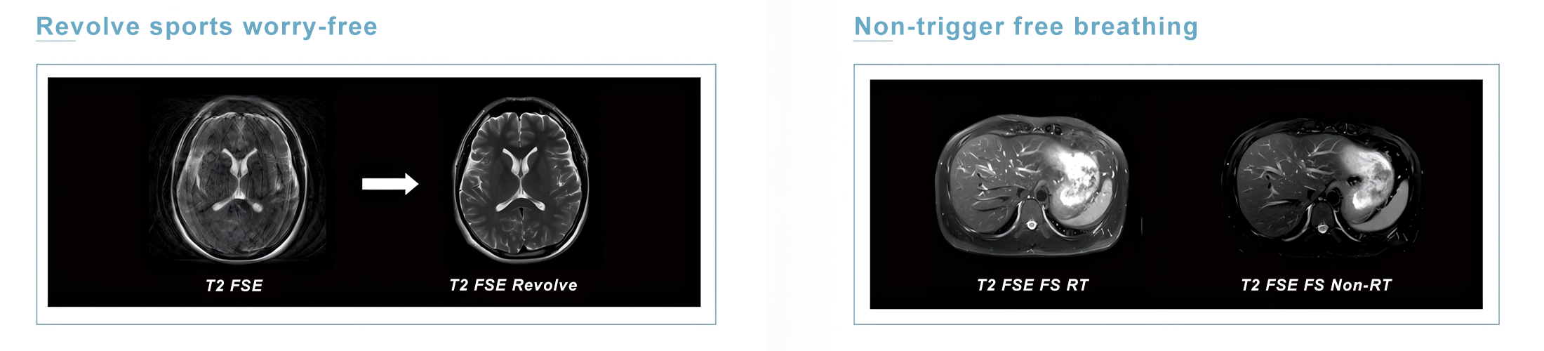 MRI medical features 6