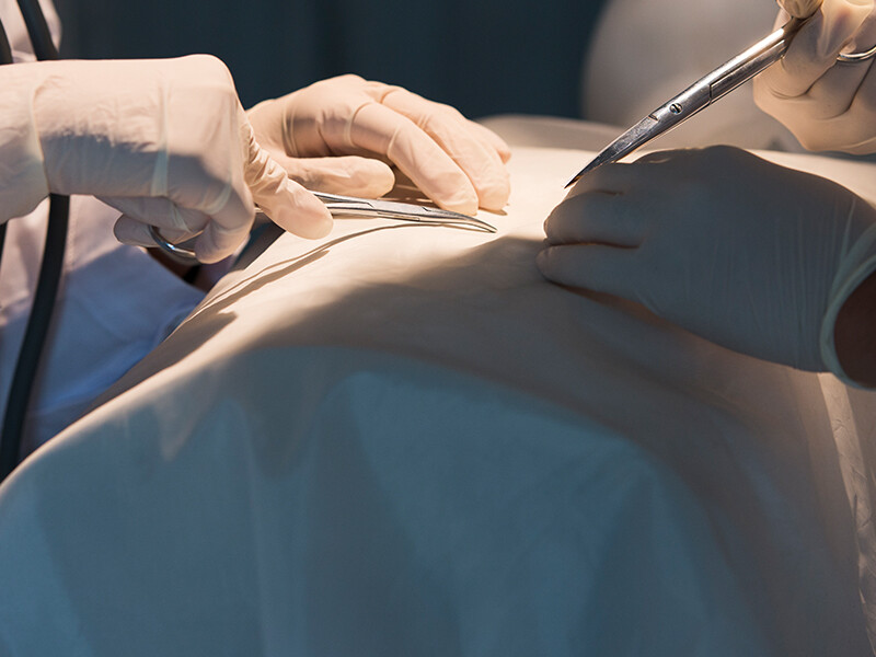 为什么我们在手术中使用手术单？