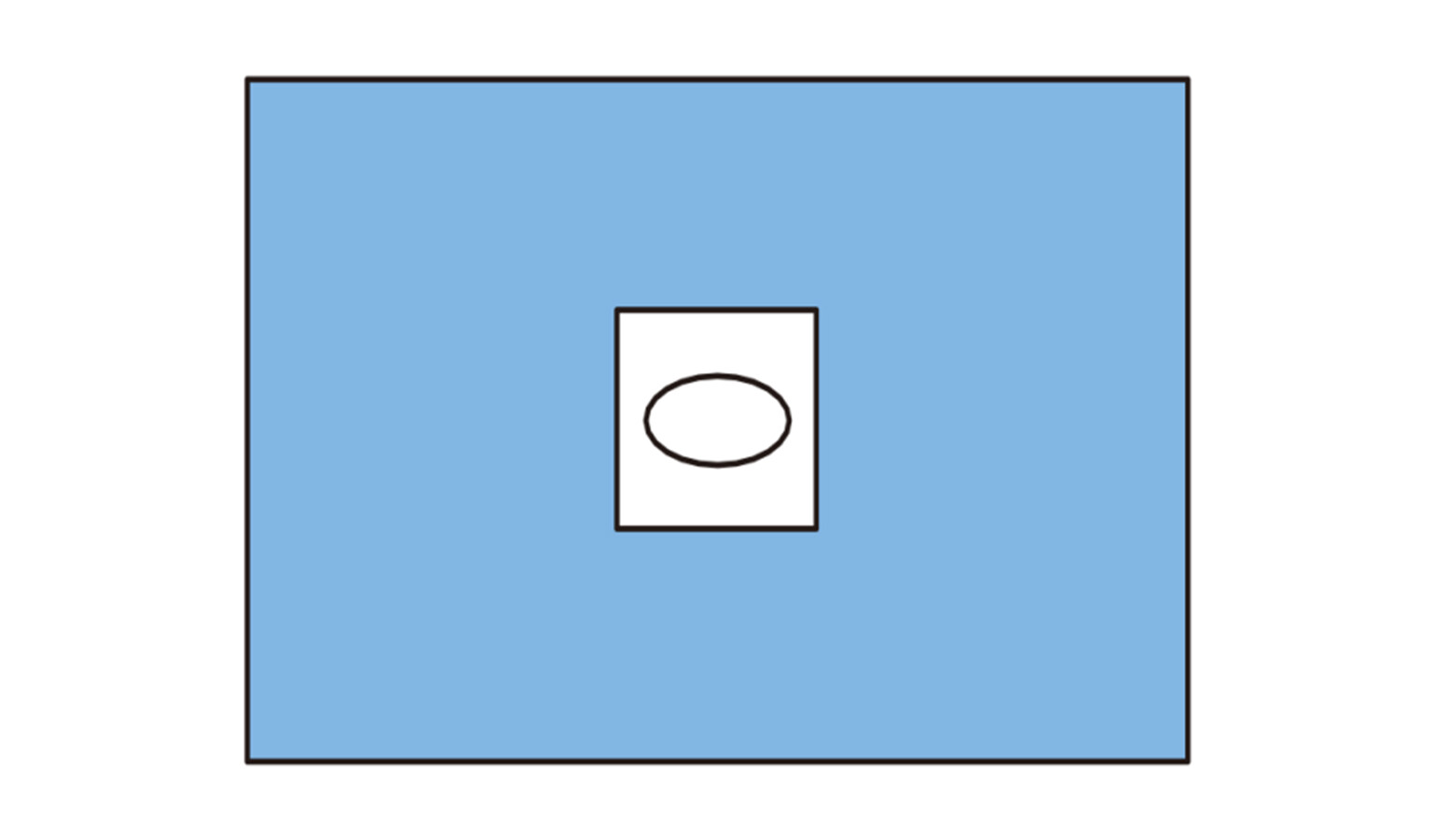 Surgery Drape With Aperture 