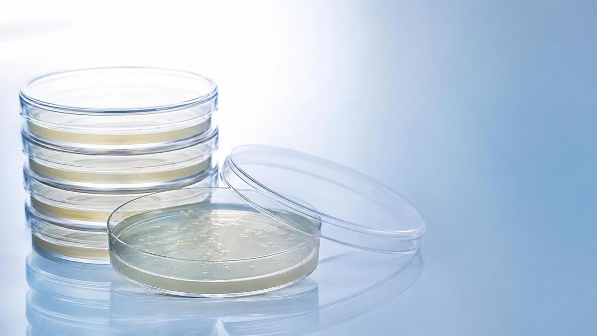 Petri Plates Explained: Materials, Sizes, and Best Uses in Microbiology Labs Petri Plates Explained: Materials, Sizes, and Best Uses in Microbiology Labs