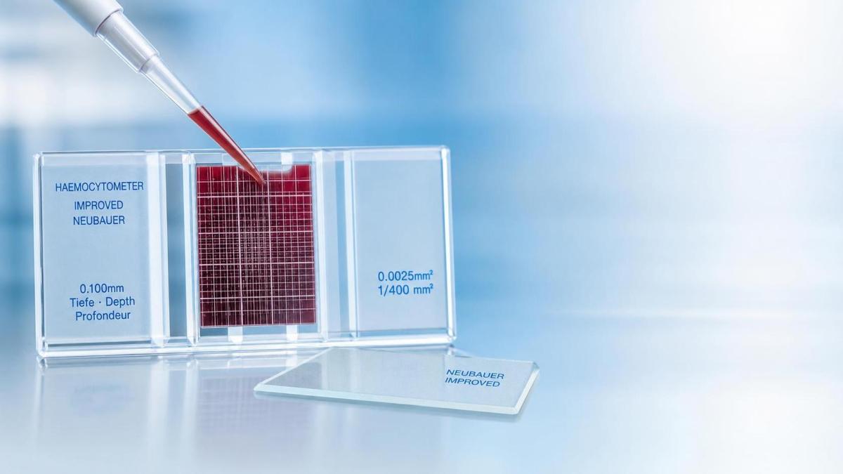 Hemacytometers for Blood Cell Counting: Accuracy Factors Users Often Overlook Hemacytometers for Blood Cell Counting: Accuracy Factors Users Often Overlook