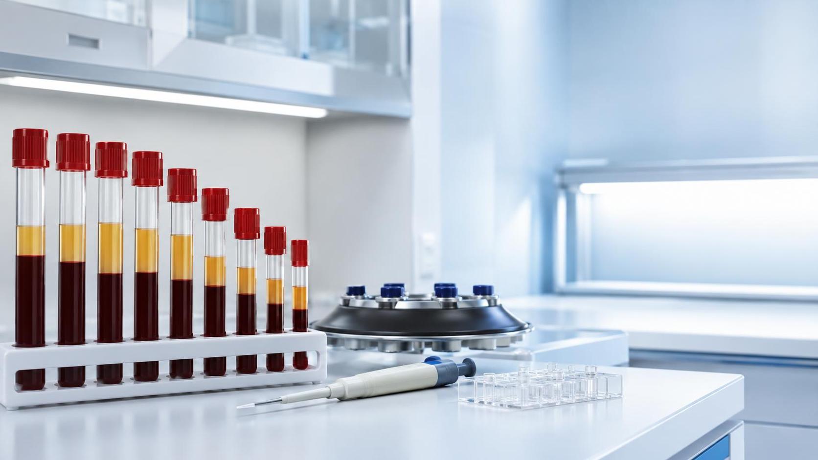 How Does 1 Test Tube Volume Affect Sample Preparation and Test Accuracy?