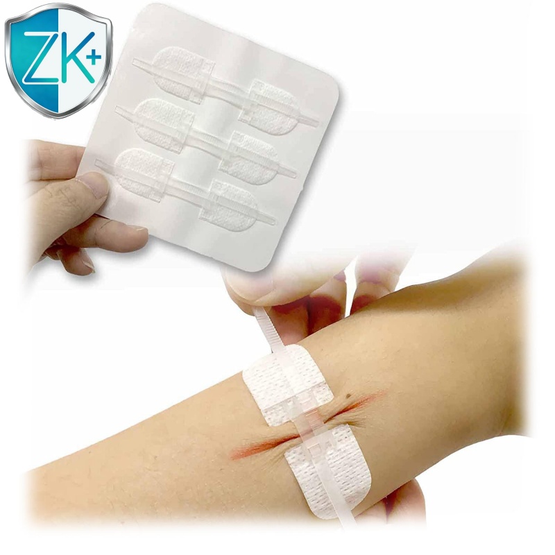 Surgical Zip-Stitch Sutures Wound Plasters Emergency Wound Closure Strips Butterfly Bandages for Painless and Seamless