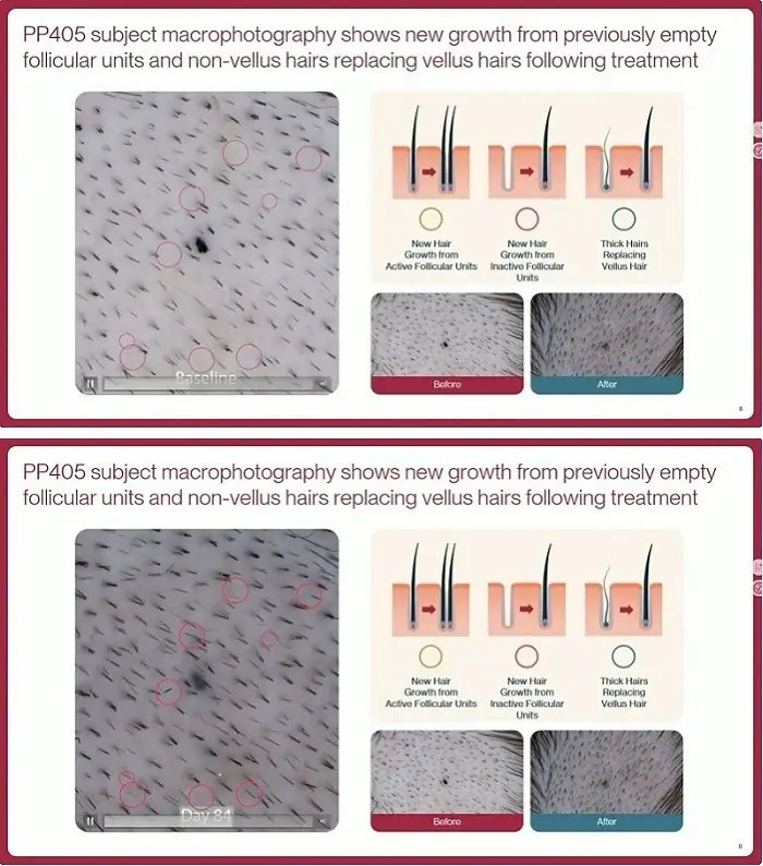 2026 Hair Dyeing Industry Explosive Product Warning - Which Products Will Lead the Future?