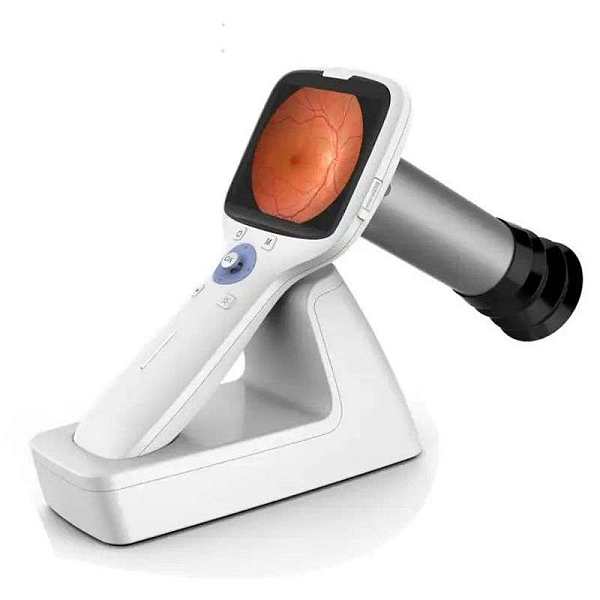 Portable Eye Fundus Retinal Camera for Eye Clinic